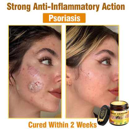 Bee Venom All-in-One Cream