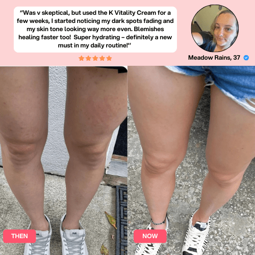 Cellulite Relief Kit